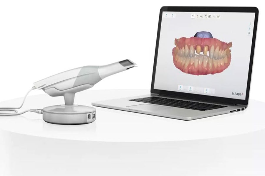 چگونه اسکنرهای دیجیتال دندانپزشکی کار می‌کنند؟