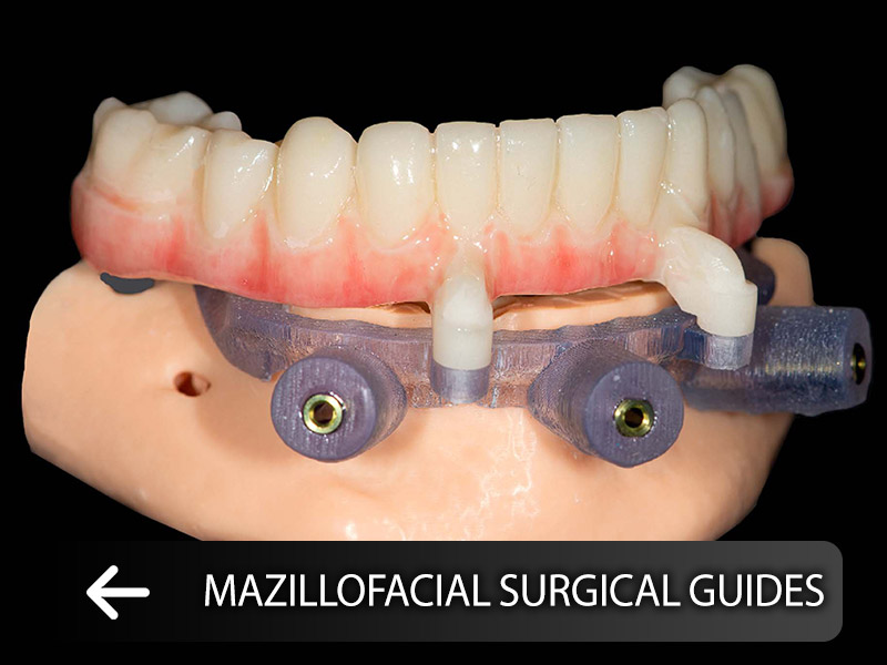Maxillofacial surgery guides